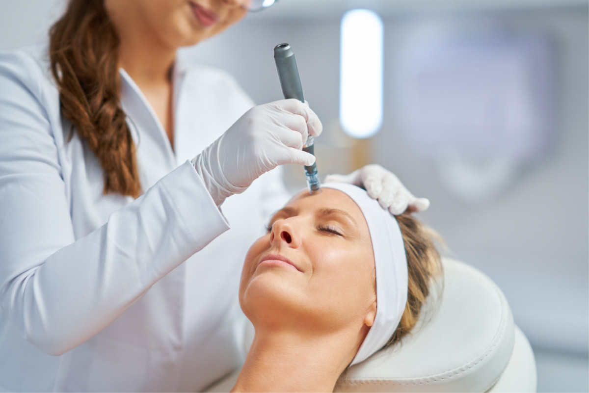 Microneedling by SkinPen® preview article image